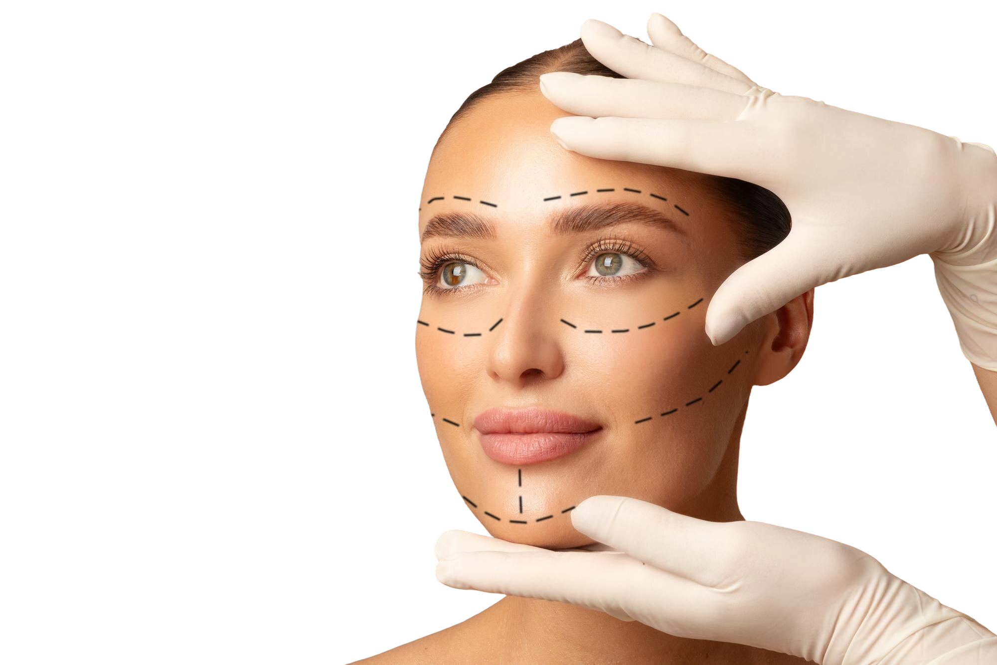 Lifting Facial - DEEP PLANE